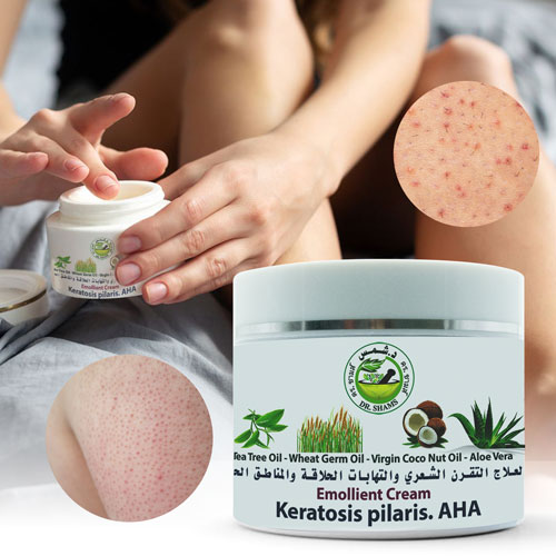 Keratosis Pilaris (Chicken Skin) Treatment Cream